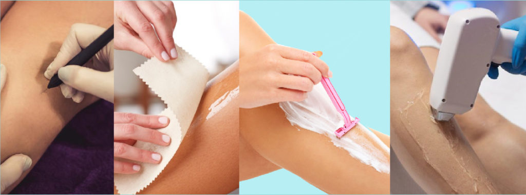 Hair Removal Methods