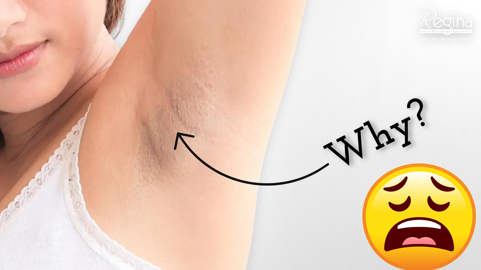 Skin Darkening & Skin Irritation After Shaving? Why?